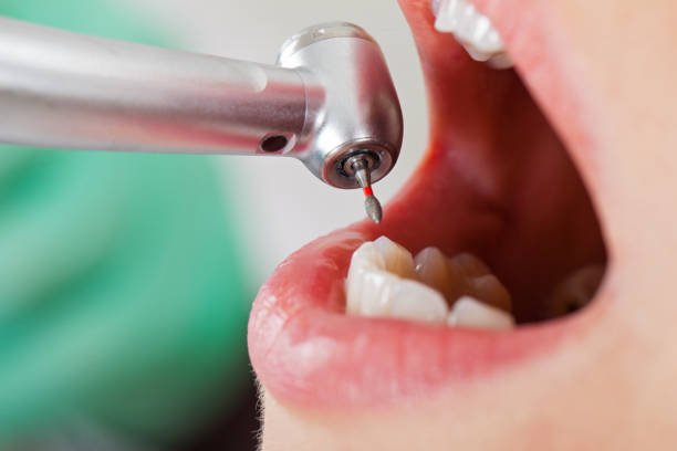 Best Walk-In Emergency Dental Services in Franklin Farm, VA